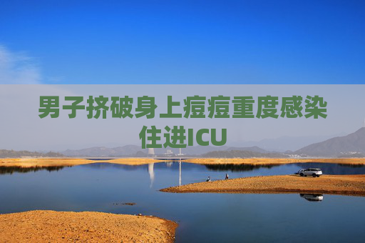 男子挤破身上痘痘重度感染住进ICU